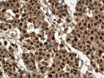 ENOPH1 Antibody in Immunohistochemistry (Paraffin) (IHC (P))