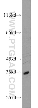 ENOPH1 Antibody in Western Blot (WB)