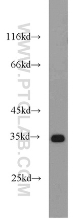 ENOPH1 Antibody in Western Blot (WB)