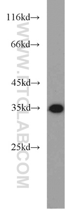 ENOPH1 Antibody in Western Blot (WB)