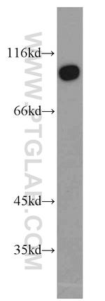 TJAP1 Antibody in Western Blot (WB)