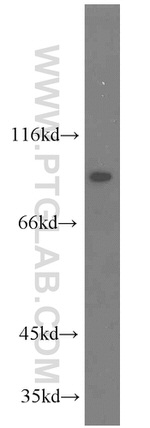 TJAP1 Antibody in Western Blot (WB)