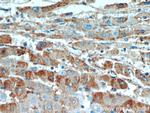 EDC4 Antibody in Immunohistochemistry (Paraffin) (IHC (P))
