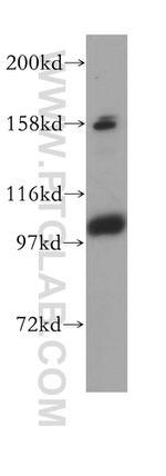 CPSF2 Antibody in Western Blot (WB)
