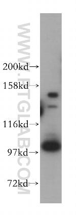 CPSF2 Antibody in Western Blot (WB)