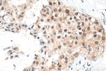 DSN1 Antibody in Immunohistochemistry (Paraffin) (IHC (P))