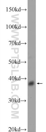 DSN1 Antibody in Western Blot (WB)
