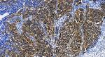 DCP2 Antibody in Immunohistochemistry (Paraffin) (IHC (P))