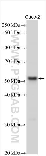 DCP2 Antibody in Western Blot (WB)