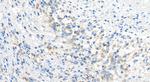 POLRMT Antibody in Immunohistochemistry (Paraffin) (IHC (P))