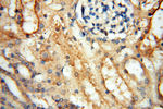 CHST14 Antibody in Immunohistochemistry (Paraffin) (IHC (P))