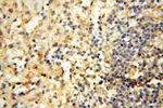 CHST14 Antibody in Immunohistochemistry (Paraffin) (IHC (P))