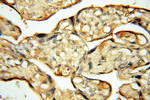 CHST14 Antibody in Immunohistochemistry (Paraffin) (IHC (P))