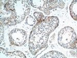 SOHLH1 Antibody in Immunohistochemistry (Paraffin) (IHC (P))