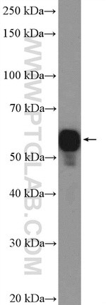 CORO1A Antibody in Western Blot (WB)