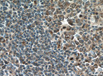 GM-CSF Antibody in Immunohistochemistry (Paraffin) (IHC (P))