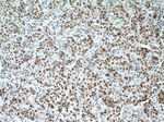 CDYL Antibody in Immunohistochemistry (Paraffin) (IHC (P))