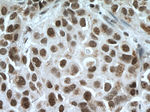 CDYL Antibody in Immunohistochemistry (Paraffin) (IHC (P))