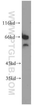 CDYL Antibody in Western Blot (WB)