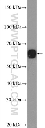 CDYL Antibody in Western Blot (WB)