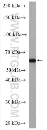 CDYL Antibody in Western Blot (WB)