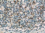 TLR3 Antibody in Immunohistochemistry (Paraffin) (IHC (P))
