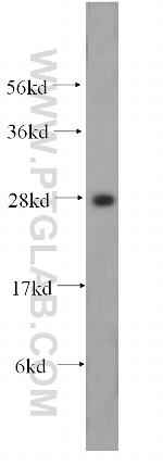 HOXD4 Antibody in Western Blot (WB)