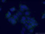 RIC8B Antibody in Immunocytochemistry (ICC/IF)