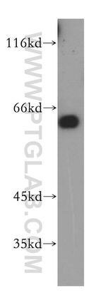 RIC8B Antibody in Western Blot (WB)