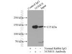 NOMO1 Antibody in Immunoprecipitation (IP)