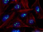 DDX47 Antibody in Immunocytochemistry (ICC/IF)