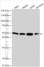 DDX47 Antibody in Western Blot (WB)