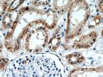 ANT1/2 Antibody in Immunohistochemistry (Paraffin) (IHC (P))