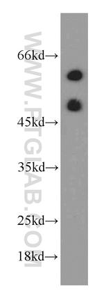 GORAB Antibody in Western Blot (WB)