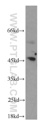 GORAB Antibody in Western Blot (WB)