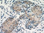 VCPIP1 Antibody in Immunohistochemistry (Paraffin) (IHC (P))