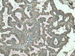 VCPIP1 Antibody in Immunohistochemistry (Paraffin) (IHC (P))