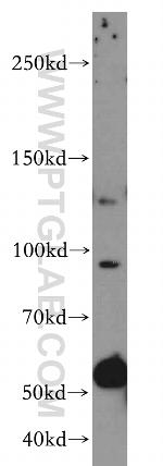 VCPIP1 Antibody in Western Blot (WB)