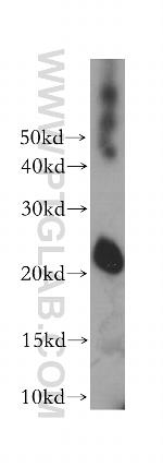 TC10 Antibody in Western Blot (WB)