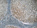 PGK1 Antibody in Immunohistochemistry (Paraffin) (IHC (P))