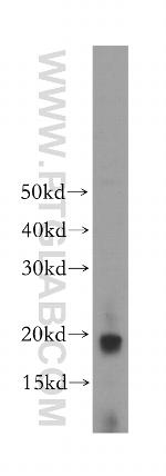 COQ10A Antibody in Western Blot (WB)