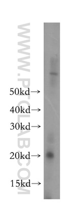 COQ10A Antibody in Western Blot (WB)