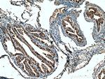 RABL2A Antibody in Immunohistochemistry (Paraffin) (IHC (P))