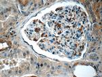 SNCAIP Antibody in Immunohistochemistry (Paraffin) (IHC (P))