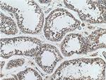 SAPS1 Antibody in Immunohistochemistry (Paraffin) (IHC (P))