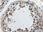SAPS1 Antibody in Immunohistochemistry (Paraffin) (IHC (P))