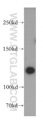 SAPS1 Antibody in Western Blot (WB)