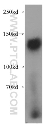 SAPS1 Antibody in Western Blot (WB)
