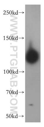 SAPS1 Antibody in Western Blot (WB)