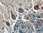 CACNA1G Antibody in Immunohistochemistry (Paraffin) (IHC (P))